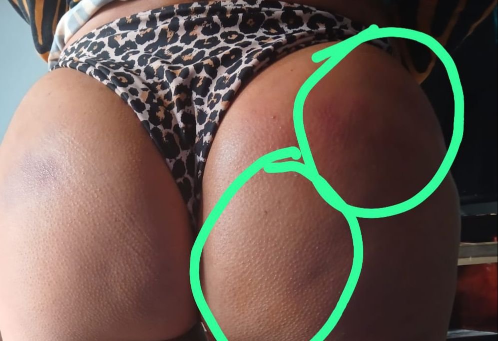 FGE sin justicia para mujer víctima de clínica de belleza en Morelia 3 FGE sin justicia para mujer victima de clinica de belleza en Morelia 2