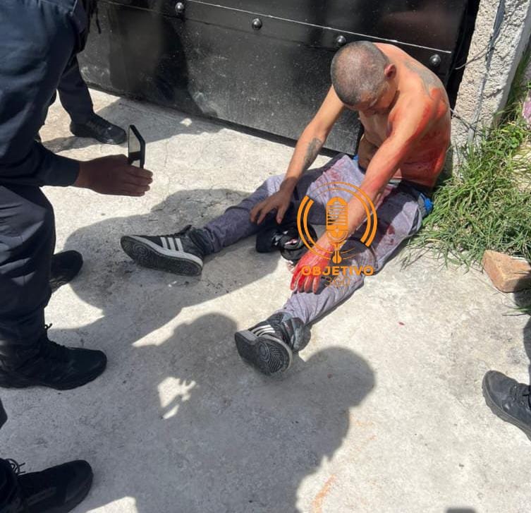 Balacera en la Lucio Cabanas deja a un hombre herido por arma de fuego 6